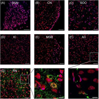 Serotonin Transporter Defect Disturbs Structure and Function of the Auditory Cortex in Mice